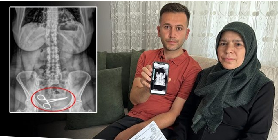 Ameliyatta karnında unutulan makasla 8 ay yaşadı